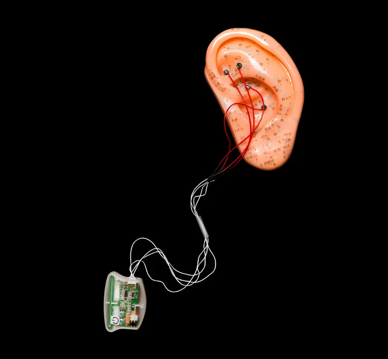 Vagus nerve stimulators deliver mild electrical pulses through the ear