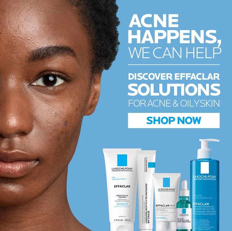 Acne happens we can help