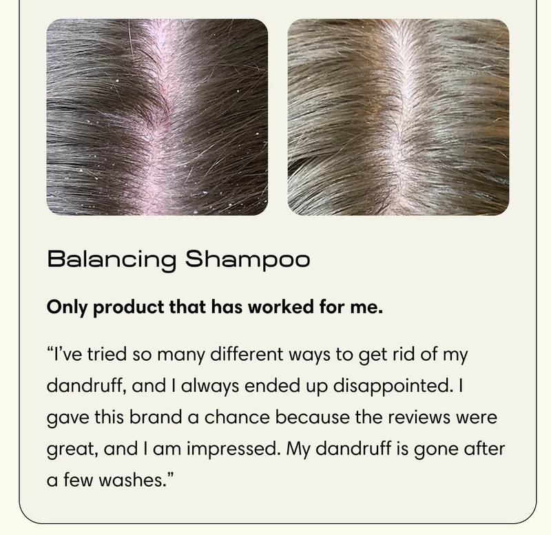 Balancing Shampoo Only product that has worked for me. “I’ve tried so many different ways to get rid of my dandruff, and I always ended up disappointed. I gave this brand a chance because the reviews were great, and I am impressed. My dandruff is gone after a few washes.”