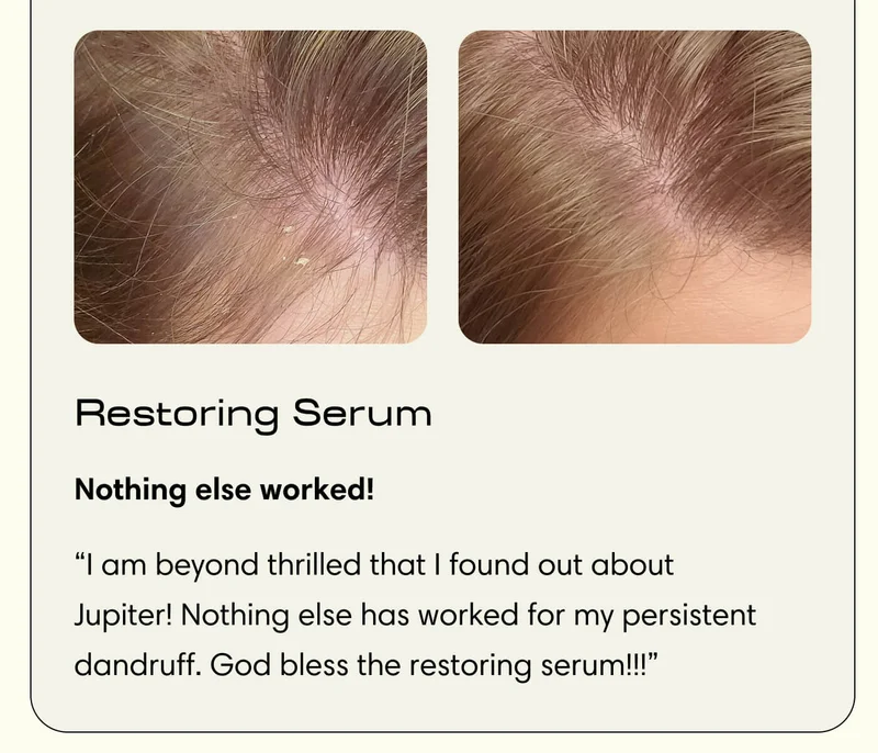 Restoring Serum Nothing else worked! “I am beyond thrilled that I found out about Jupiter! Nothing else has worked for my persistent dandruff. God bless the restoring serum!!!”