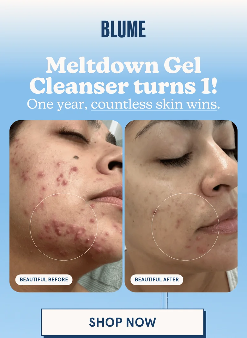 BLUME: Meltdown Gel Cleanser turns 1! One year, countless skin wins. [SHOP NOW]