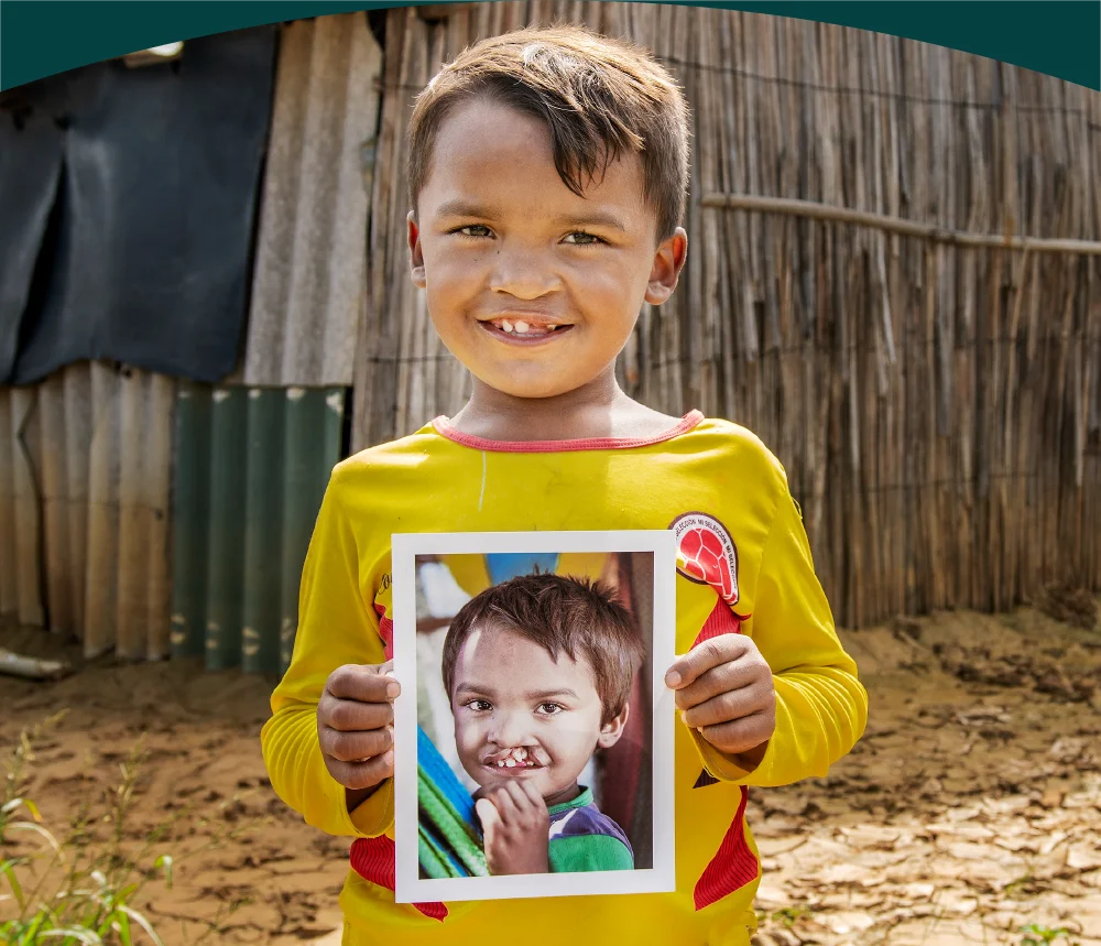 Operation Smile