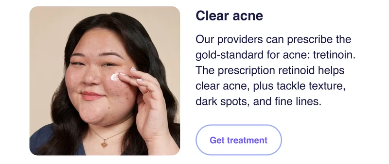 Clear acne | Get treatment