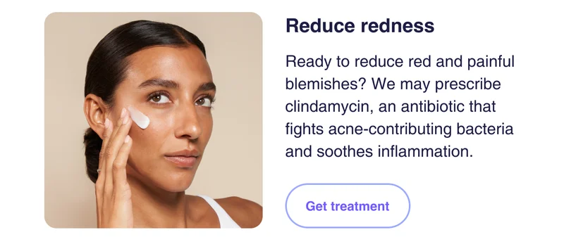 Reduce redness | Get treatment