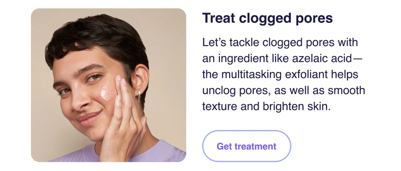 Treat clogged pores | Get treatment