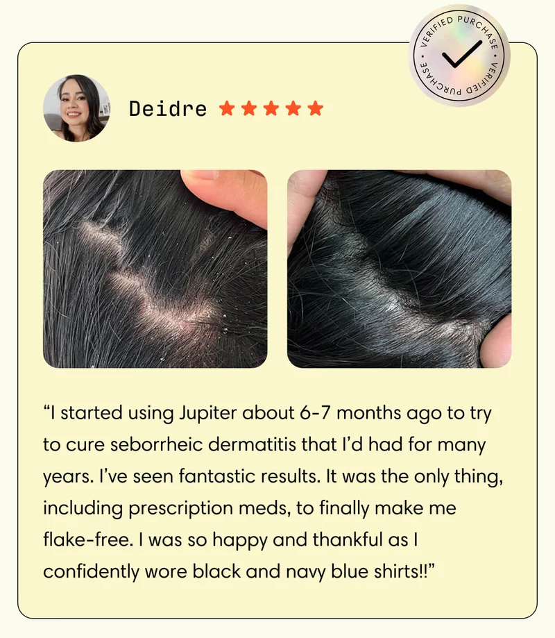 Deidre // Verified Purchase // “I started using Jupiter about 6-7 months ago to try to cure seborrheic dermatitis that I’d had for many years. I’ve seen fantastic results. It was the only thing, including prescription meds, to finally make me flake-free. I was so happy and thankful as I confidently wore black and navy blue shirts!!”