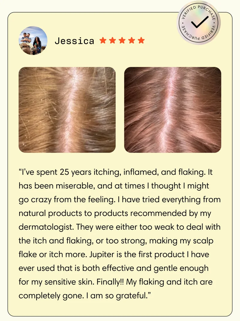 Jessica // Verified Purchase // “I’ve spent 25 years itching, inflamed, and flaking. It has been miserable, and at times I thought I might go crazy from the feeling. I have tried everything from natural products to products recommended by my dermatologist. They were either too weak to deal with the itch and flaking, or too strong, making my scalp flake or itch more. Jupiter is the first product I have ever used that is both effective and gentle enough for my sensitive skin. Finally!! My flaking and itch are completely gone. I am so grateful.”