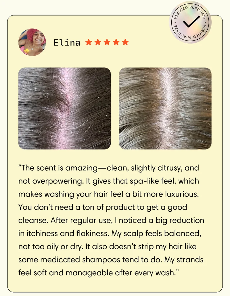 Elina // Verified Purchase // “The scent is amazing—clean, slightly citrusy, and not overpowering. It gives that spa-like feel, which makes washing your hair feel a bit more luxurious. You don’t need a ton of product to get a good cleanse. After regular use, I noticed a big reduction in itchiness and flakiness. My scalp feels balanced, not too oily or dry. It also doesn’t strip my hair like some medicated shampoos tend to do. My strands feel soft and manageable after every wash.”
