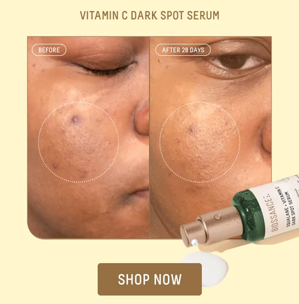 Vitamin C Dark Spot