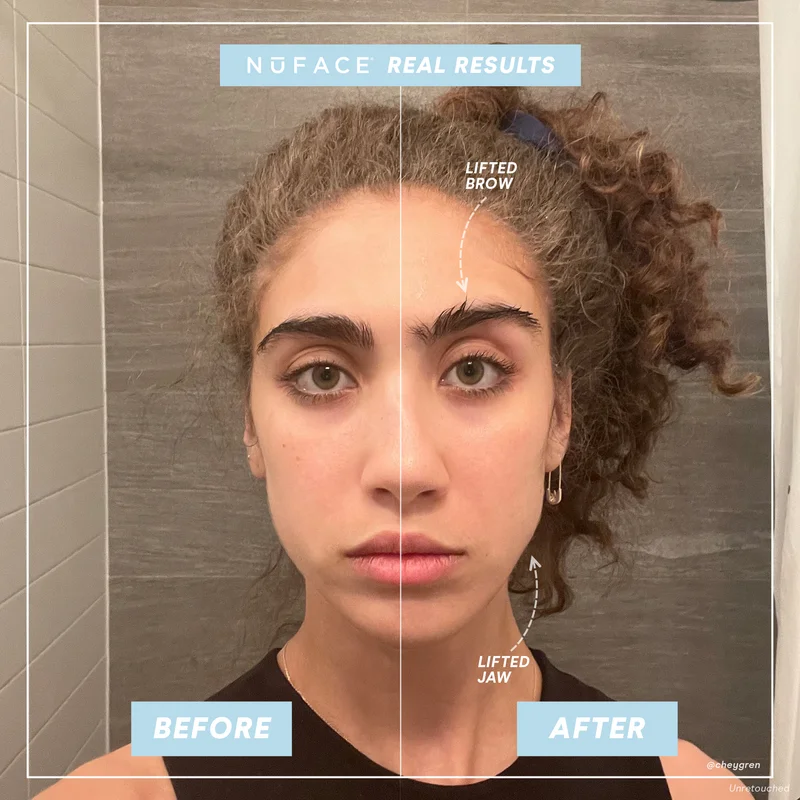 TikTok's @cheygren's NuFACE Results, showing Before and After photos side-by-side
