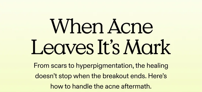 When Acne Leaves Its Mark From scars to hyperpigmentation, the healing doesn’t stop when the breakout ends. Here’s how to handle the acne aftermath.