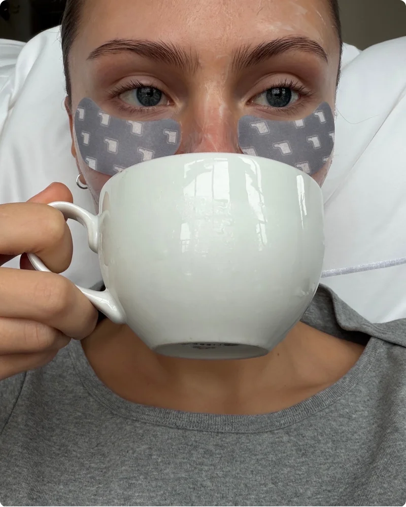 peptide eye prep