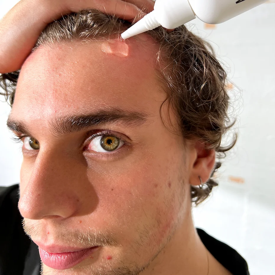 Image of product tester using hair growth serum