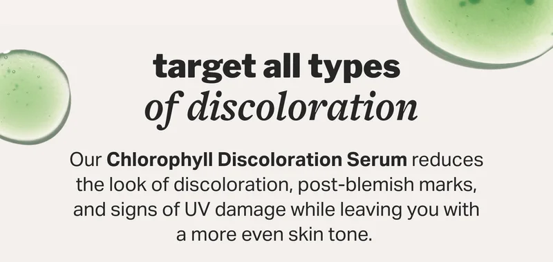 treat all types  of discoloration