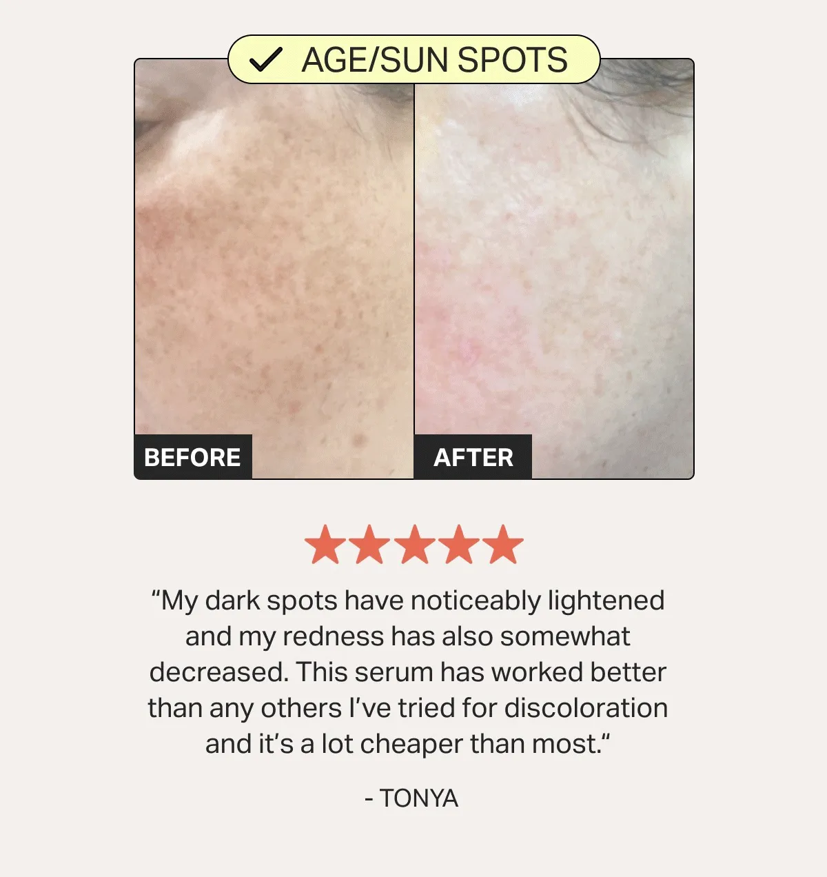 AGE/SUN SPOTS REDNESS Post-blemish marks AGE/SUN SPOTS