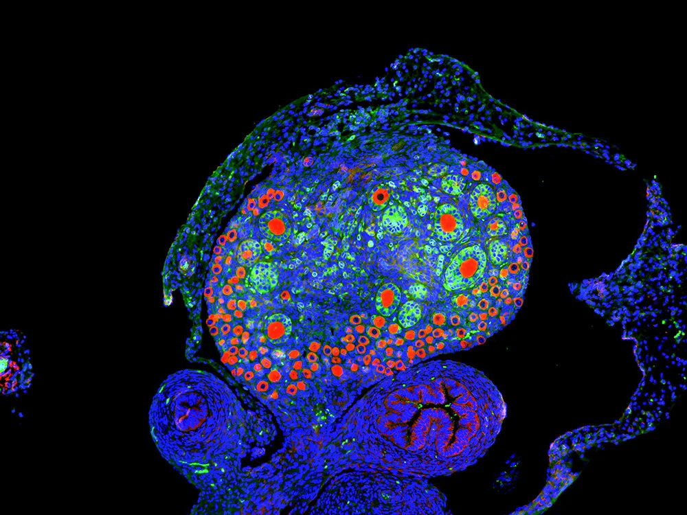 A normal, untreated mouse ovary, which shows both smaller immature oocytes and larger activated oocytes.