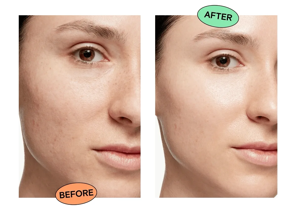 Before and After