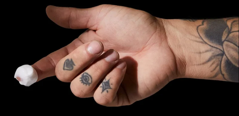 [ an image os a hand with some numbing cream ]