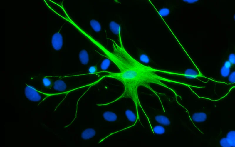 This fluorescent microscope image shows a human astrocyte. Glial fibrillary acidic protein—a key structural filament—appears in green, while cell nuclei are stained blue.