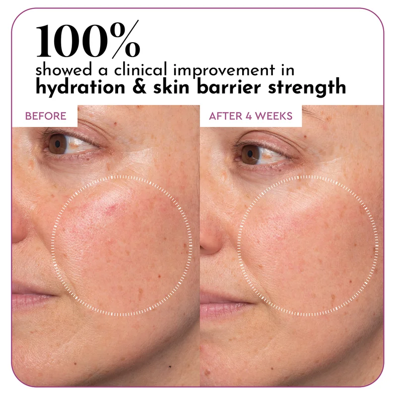 Prickly Pear Peptide