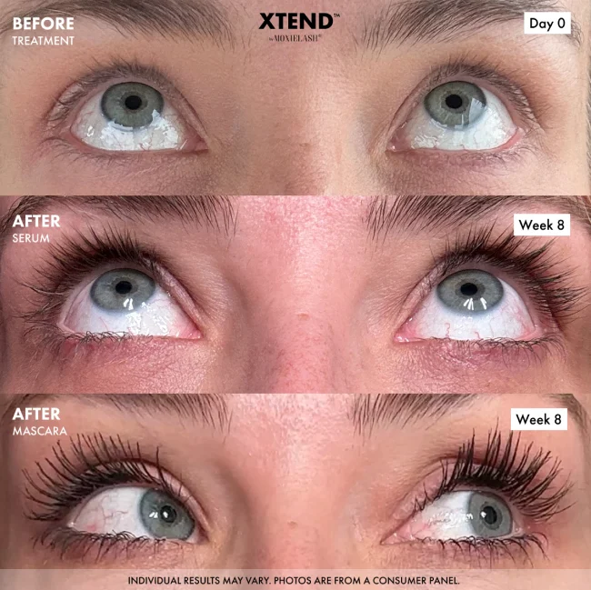 Before and After