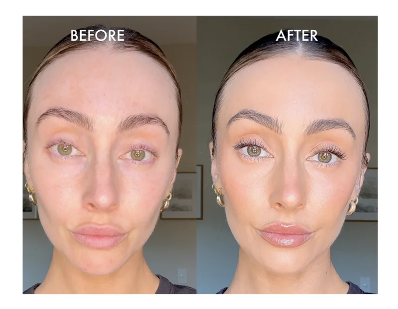 Before and After