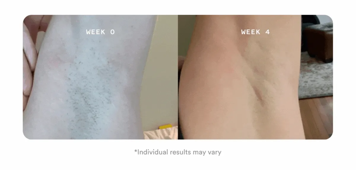 Flasher Pro Before & After Images