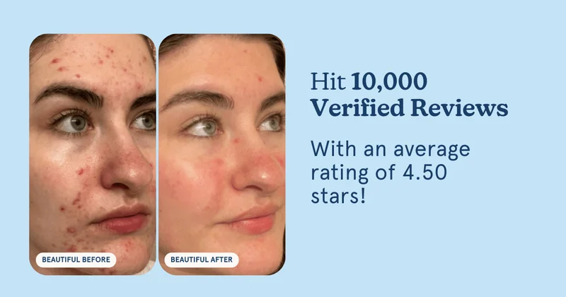 Hit 10,000 verified reviews!