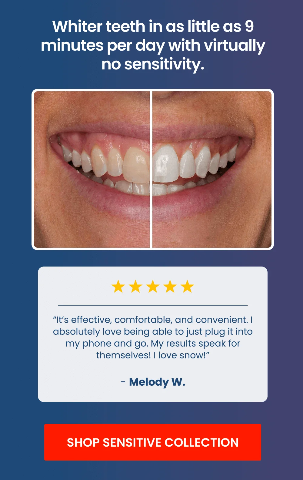 Whiter teeth in as little as 9 minutes per day with virtually no sensitivity. “It’s effective, comfortable, and convenient. I absolutely love being able to just plug it into my phone and go. My results speak for themselves! I love snow!” - Melody W. [SHOP SENSITIVE COLLECTION]