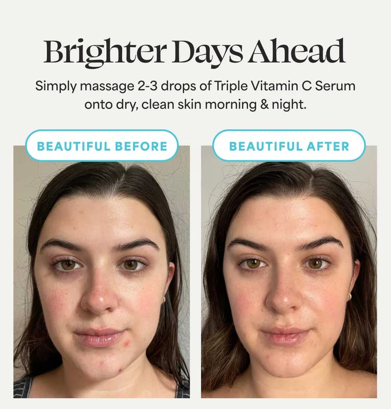 Brighter days ahead Simply massage 2-3 drops of Triple Vitamin C Serum onto dry, clean skin morning & night.