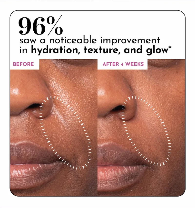 Prickly Pear Peptide Mucin Before & After
