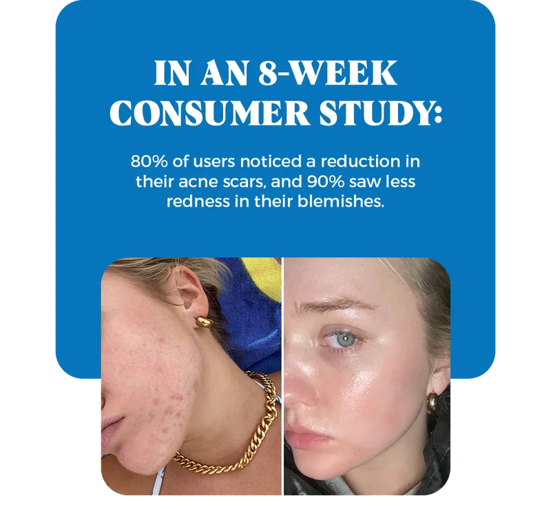 IN AN 8 WEEK CONSUMER STUDY