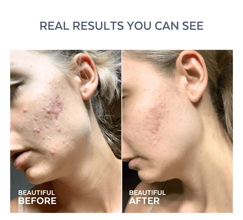 REAL RESULTS YOU CAN SEE [BEAUTIFUL BEFORE | BEAUTIFUL AFTER]
