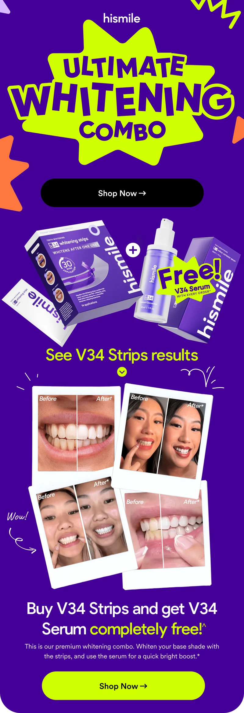 Hismile. Ultimate Whitening Combo! Buy V34 Strips and get V34 Serum completely free! This is our premium whitening combo. Whiten your base shade with the strips, and use the serum for a quick bright boost.* Shop now!