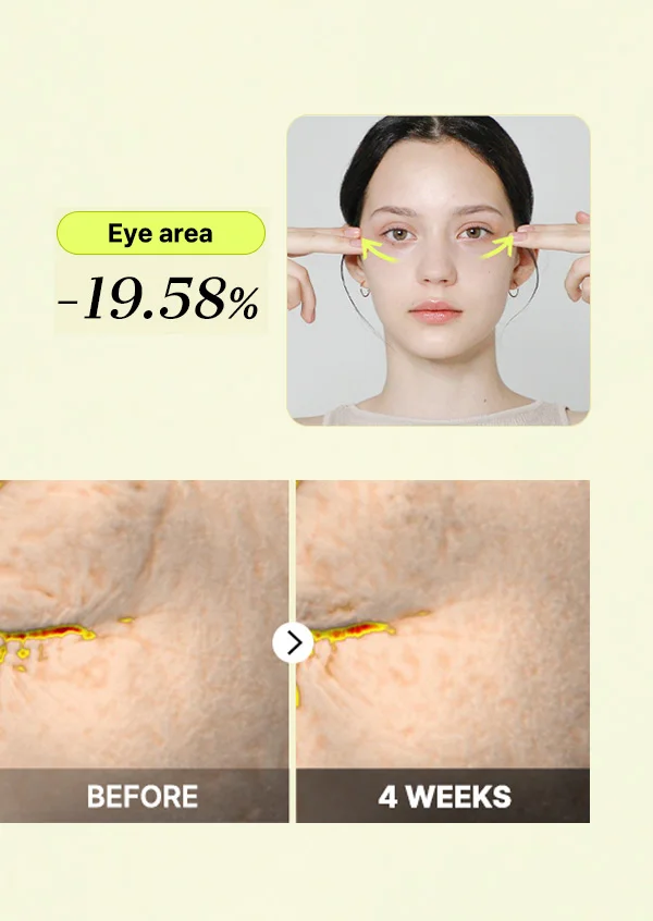 /Clinical Results in 4 weeks/ Eye area -19.58% decreased