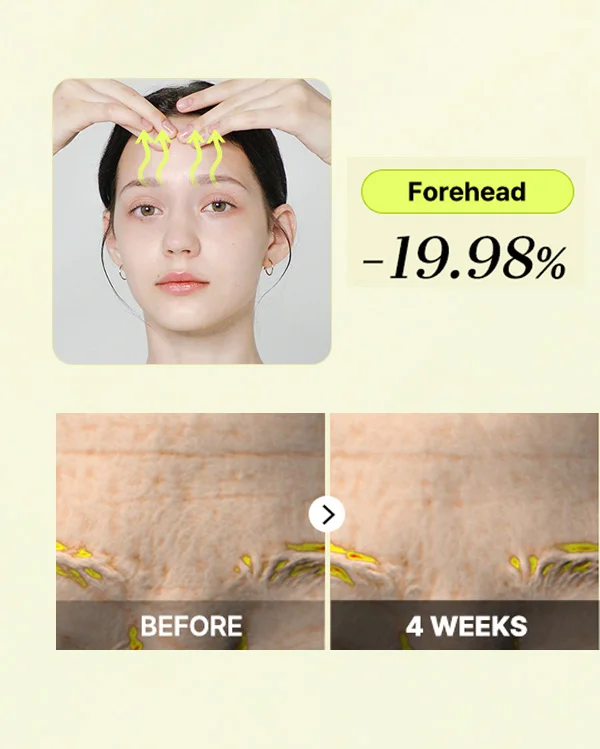 /Clinical Results in 4 weeks/ Forehead -19.98% decreased