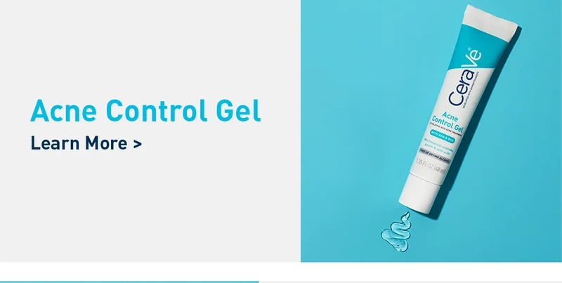 Acne Control Gel