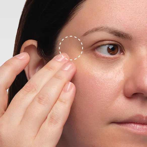 Volufiline 92% + Pal-Isoleucine 1% is a plumping serum formulated to address volume loss.