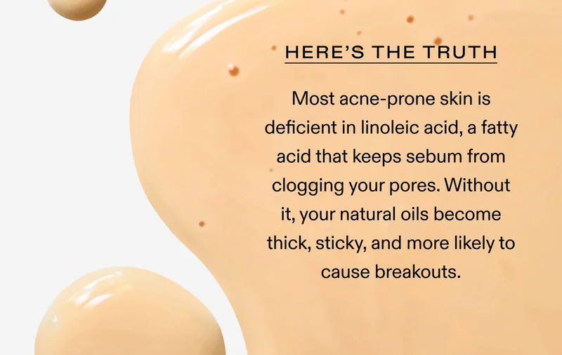 Here’s The Truth Most acne-prone skin is deficient in linoleic acid, a fatty acid that keeps sebum from clogging your pores. Without it, your natural oils become thick, sticky, and more likely to cause breakouts.