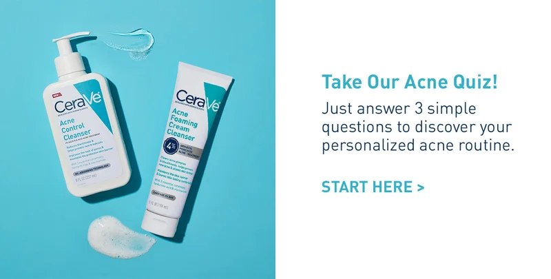 Take Our Acne Quiz!