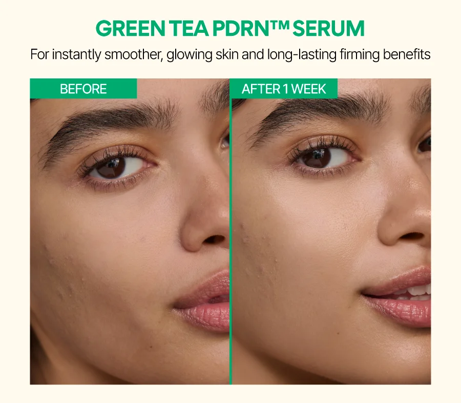 GREEN TEA PDRN™ SERUM