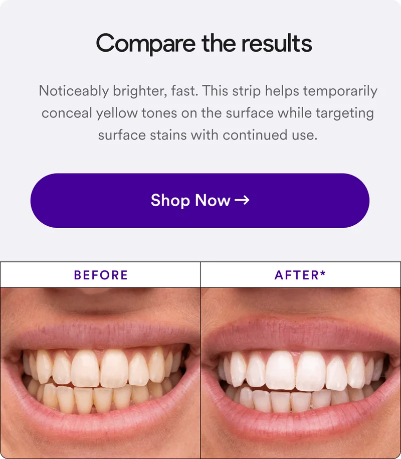 Noticeably brighter, fast. This strip helps temporarily conceal yellow tones on the surface while targeting surface stains with continued use.