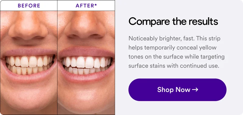 Noticeably brighter, fast. This strip helps temporarily conceal yellow tones on the surface while targeting surface stains with continued use.