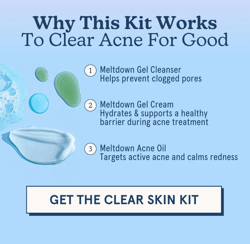 Why This Kit Works To Clear Acne For Good: Meltdown Gel Cleanser Helps prevent clogged pores | Meltdown Gel Cream Hydrates & supports a healthy barrier during acne treatment | Meltdown Acne Oil Targets active acne and calms redness [GET THE CLEAR SKIN KIT]