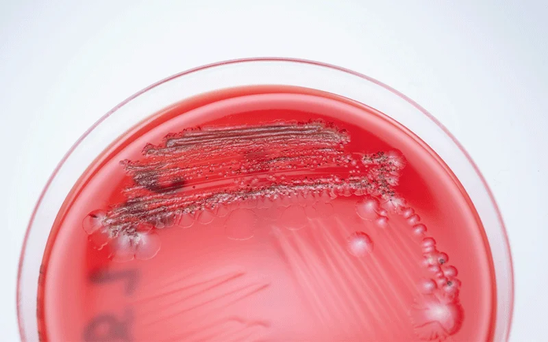 Inside a petri dish, bacterial colonies (appearing as dark spots) grow from stool collected from a person living in an isolated community near San Marcos Sierras, Argentina.
