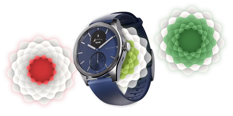 ScanWatch 2